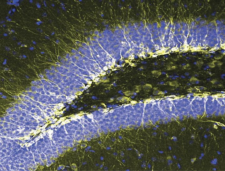 New Born Cells in the Hippocampus
