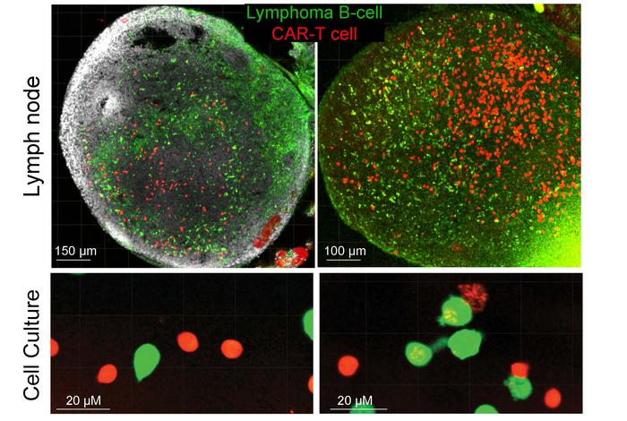 Anticancer Drugs Could Make Immunotherapies More Effective