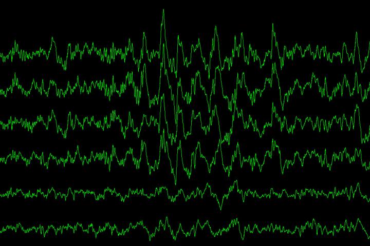 Slow-Wave Brain Waves