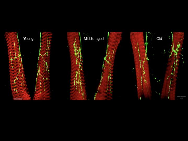 Adult Drosophila motor terminals and muscles