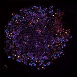 lab-grown kidney structure