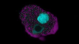 An amoeba cell infected by Naegleriavirus. The fluorescence microscopy image shows the viral factory and newly produced virus particles (in blue) within the amoeba cell (pink).