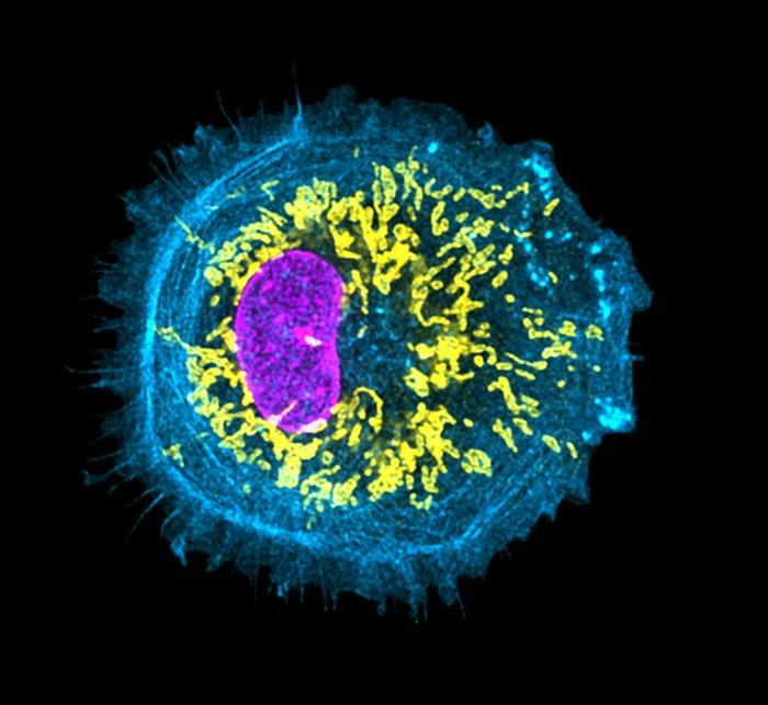 Super-resolution image of human stem cell-derived Microglia cells with labeled mitochondria (yellow), nucleus (magenta), and actin filaments (cyan). These Microglia cells help in the maturation of neurons in human brain organoid models.