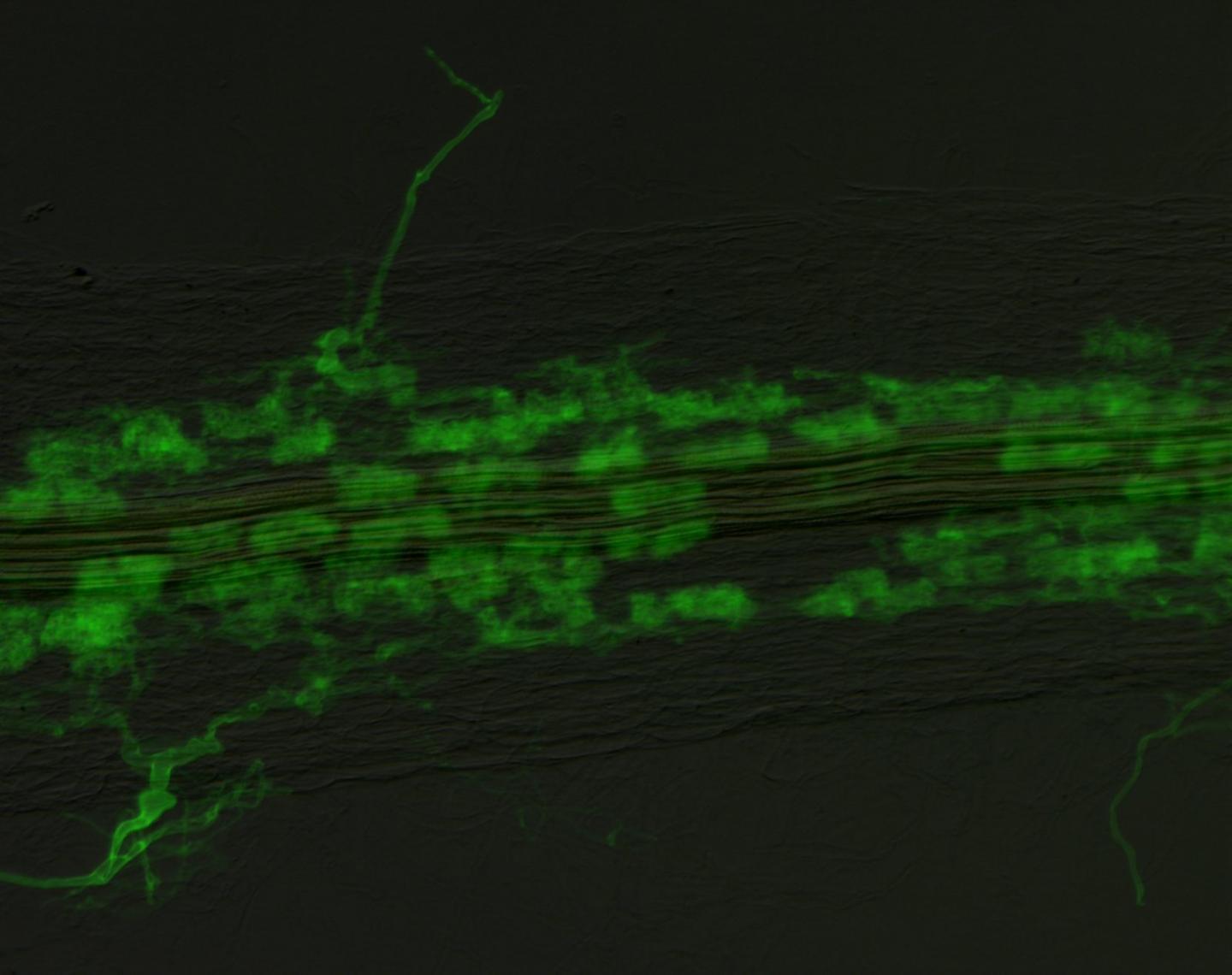Arbuscules in Root Cortex