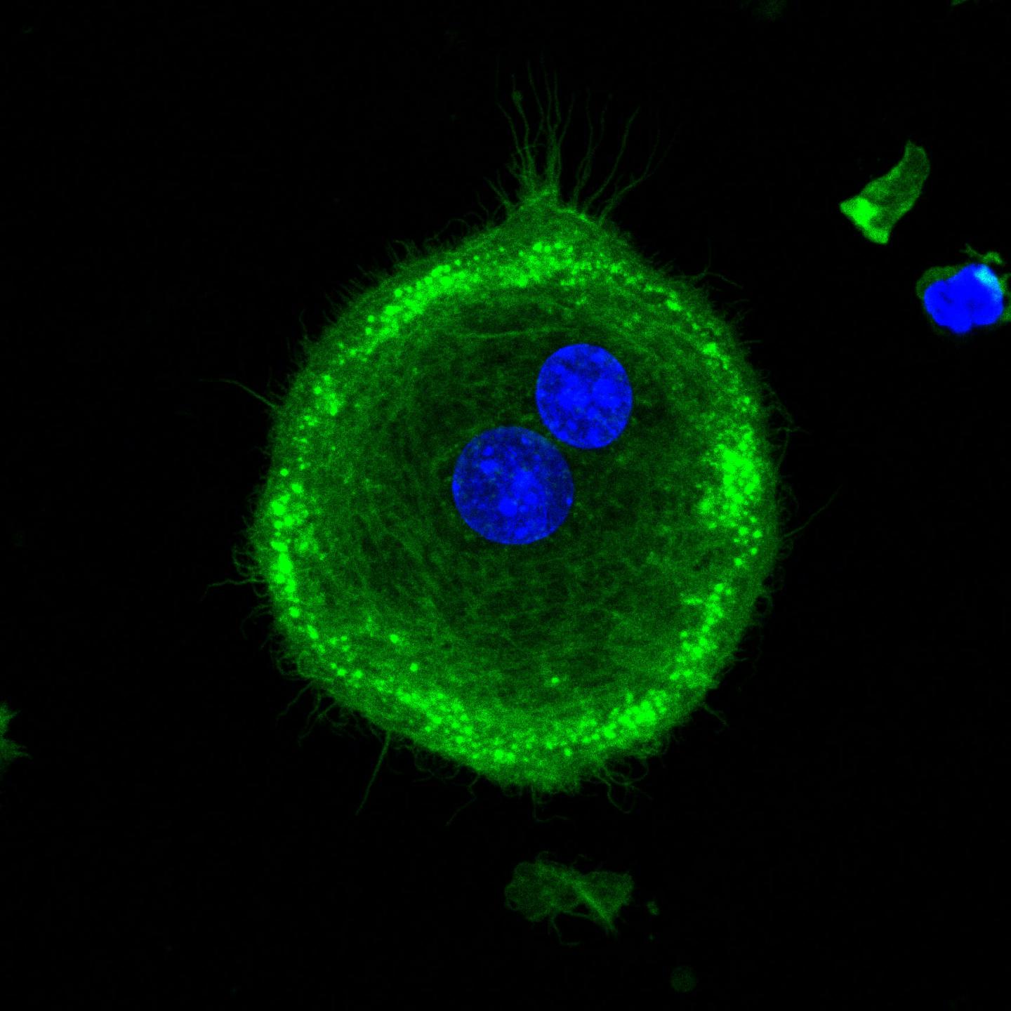 Osteoclasts with Adseverin