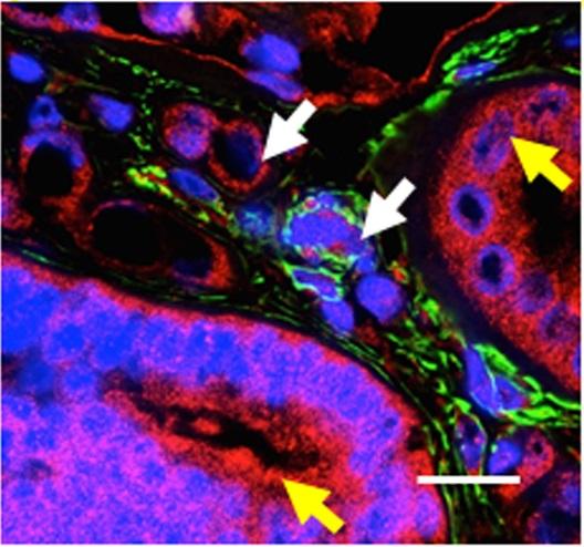 SMOC2 in Kidney Fibrosis