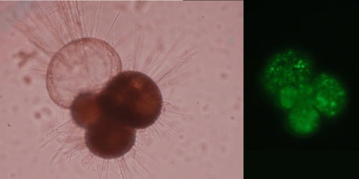 Microscopic Pictures of Foraminifers