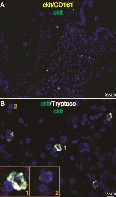 Innate Lymphoid Cells Linked to Asthma