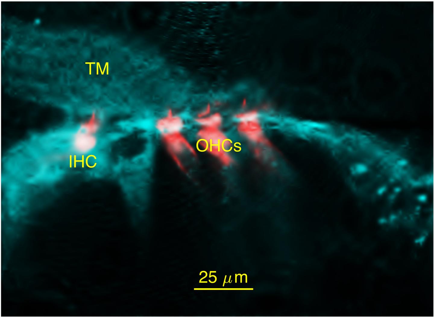 Confocal micrograph of hair cells in the inner ear