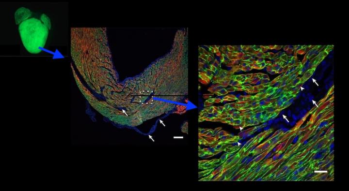 Gene therapy in the heart