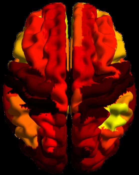 Hierarchical distribution of connections represented in colors on the surface of a human brain.