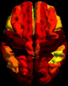 Hierarchical distribution of connections represented in colors on the surface of a human brain.