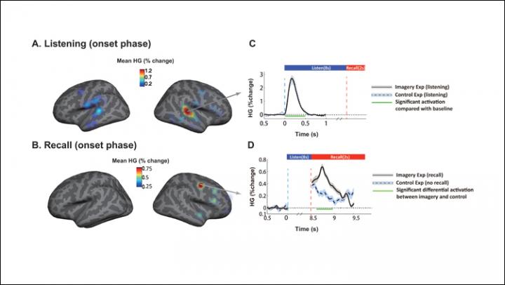 Music in the Brain