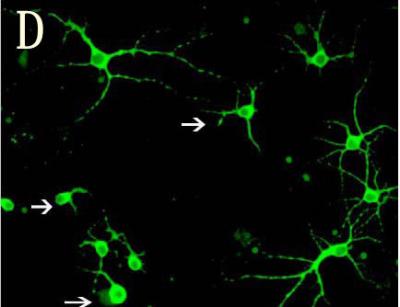 Microtubule-Associated Protein 2 Expression