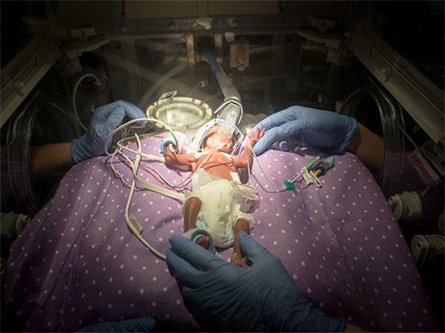 UAB Only University Awarded Grants in All 3 Perinatal Networks