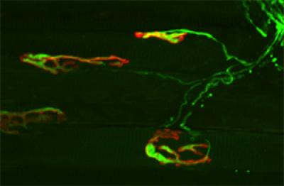 Scientists Show How Nerve Wiring Self-Destructs