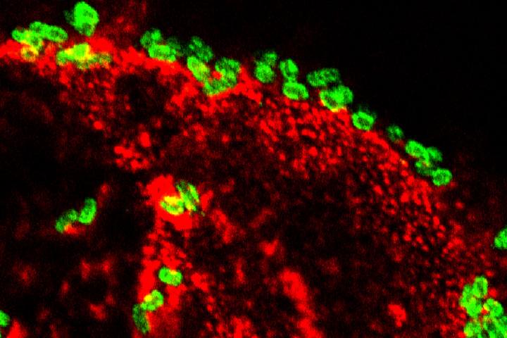 ETEC on cells