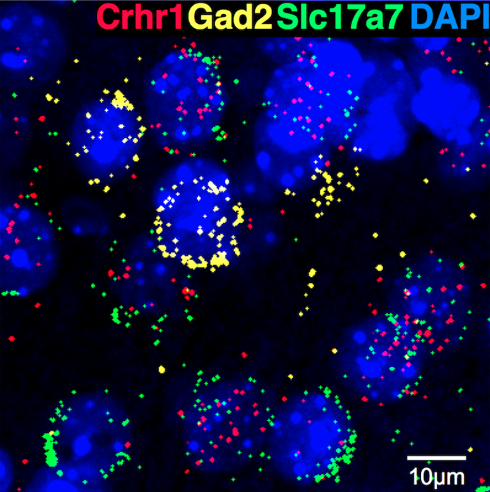 Immune protein may drive alcoholism relapse