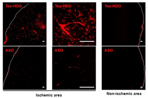 Distribution of IV-administered Toc-HDO in ischemic area and non-ischemic area