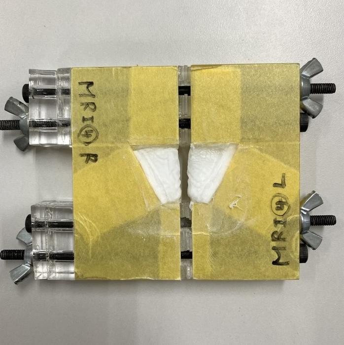 Silicone model representing the vocal folds