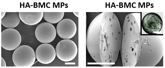 Protective Microparticles Shield and Deliver Micronutrients to People (1 of 2)