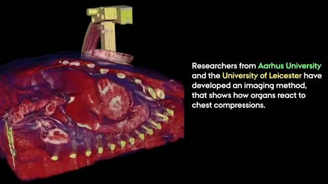 CPR - a Look Inside