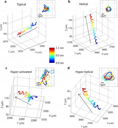 The Motion of Human Male Gamete Cells