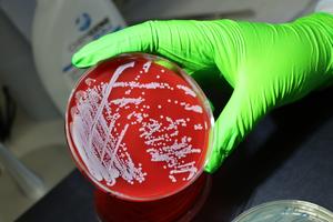 Staphylococcus aureus on petri dish