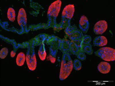 How Beetles Keep Bacteria in Check (15 of 15)