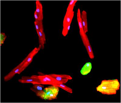 Heart Muscle Cells