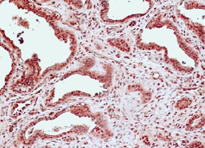 Aurura A in PKD Cysts