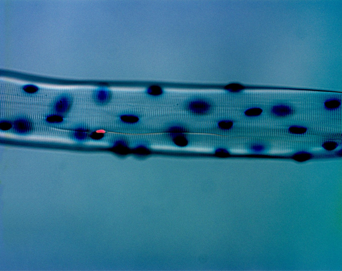 The first picture of a satellite cell taken by Professor Partridge when the proteins to mark satellite cells