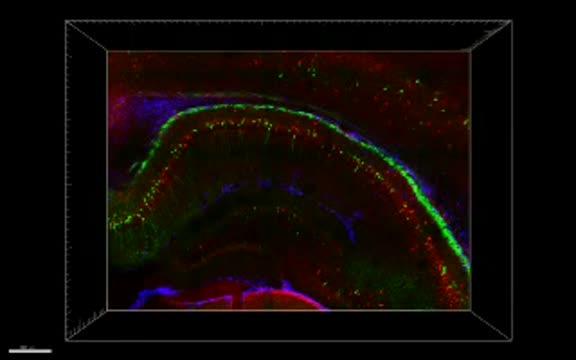 3-D Analysis of Intact Mouse Hippocampus
