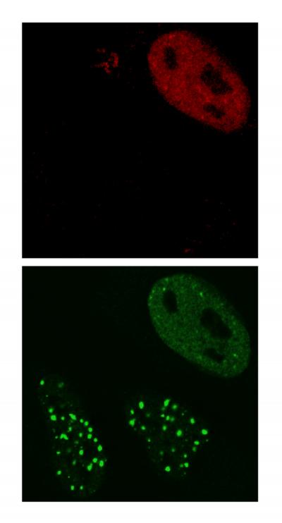 Unwanted Guests: How Herpes Simplex Virus Gets Rid of the Cell's Security Guards
