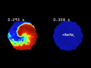 Gene Therapy Stopping Cellular Arrhythmia