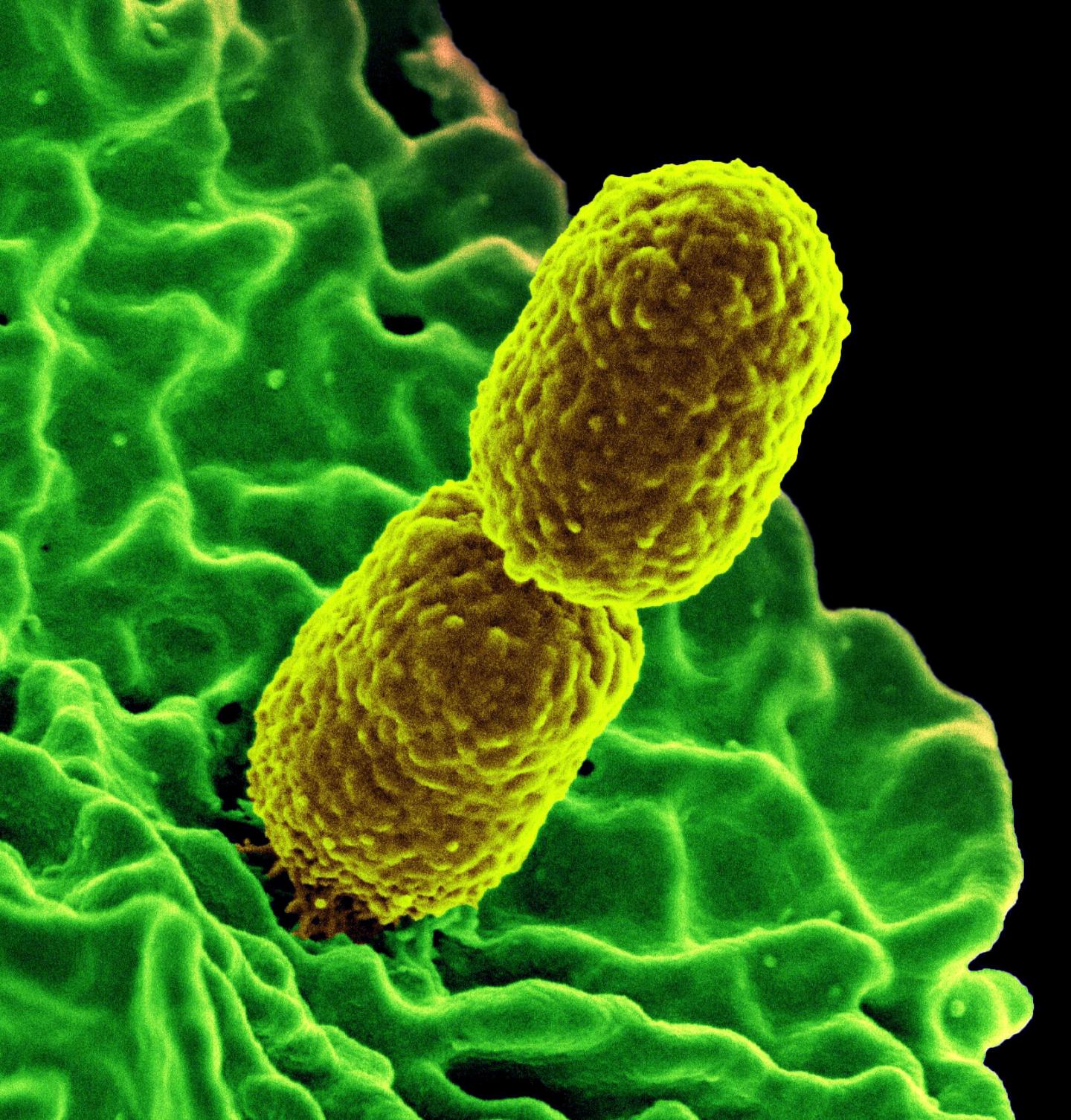 Klebsiella