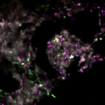 Visualizing the Action of Stained Immune Cells