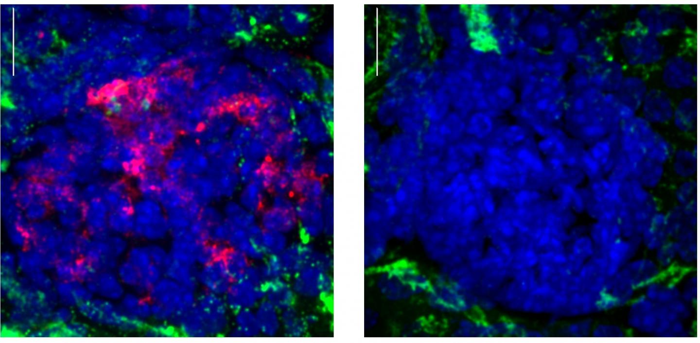 Buildup of Abnormal Antibodies