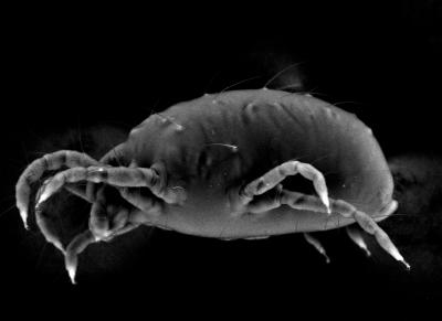 Electron Microscope Image of Spider Mite