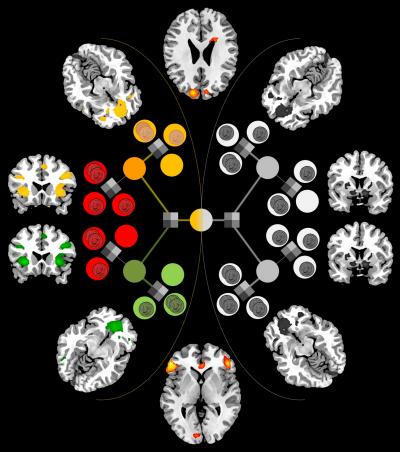 Pinpointing the Brain's Arbitrator