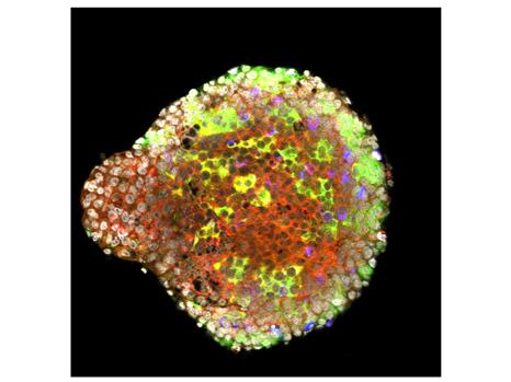Pancreatic Islet of Langherans