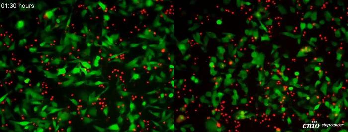 Fluorescence microscopy imaging to study immunosuppressants in melanoma.