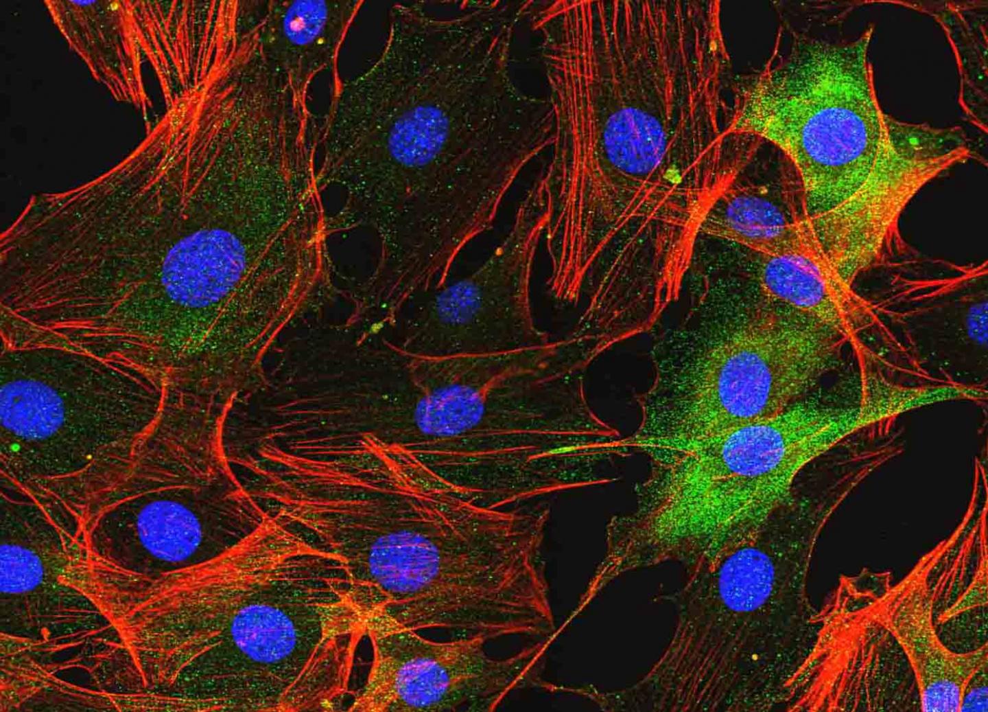 Potential new drug target for the treatment o | EurekAlert!