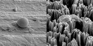 Candida fungus on two surfaces