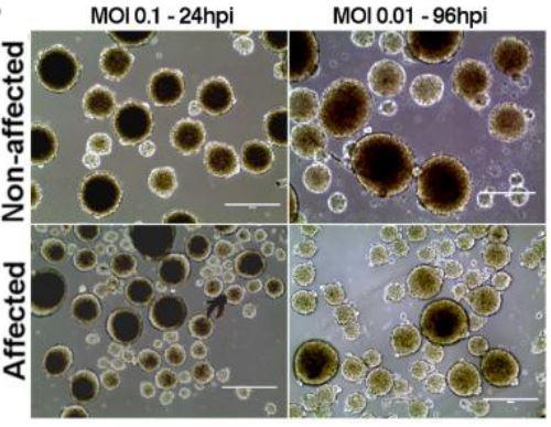 Neurospheres Produced From Cells of Babies Affected By Congenital Zika Syndrome