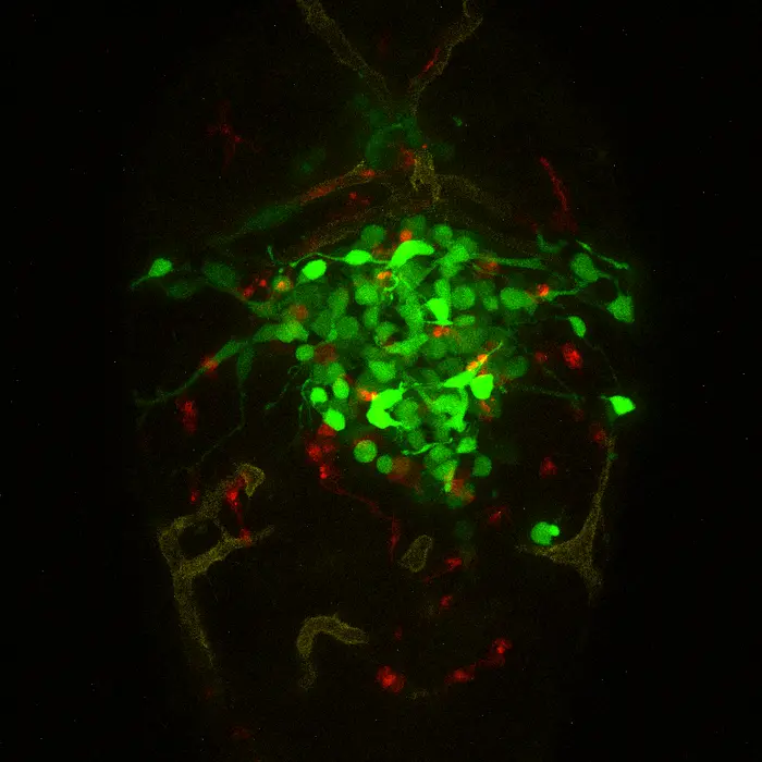 Brain region of a zebrafish avatar bearing a human glioblastoma tumor