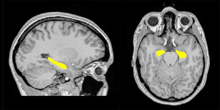 hippocampus-image-eurekalert-science-news-releases