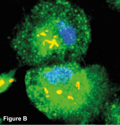 Figure B - TB After Autophagy
