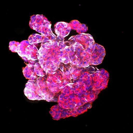 3D Imagery of Mammary Organoid