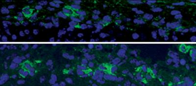Vangl2-lacking Mouse Embryo Brain Lacks Early-born Neurons
